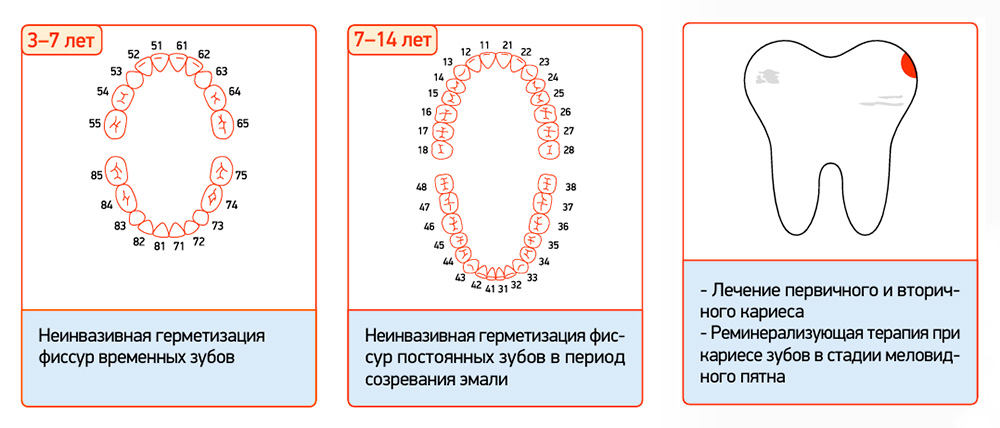 СМ_Флюор_04